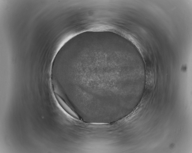 X0000098181487200805081013