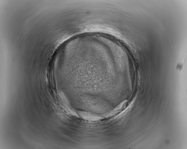 X0000098181497200805081012