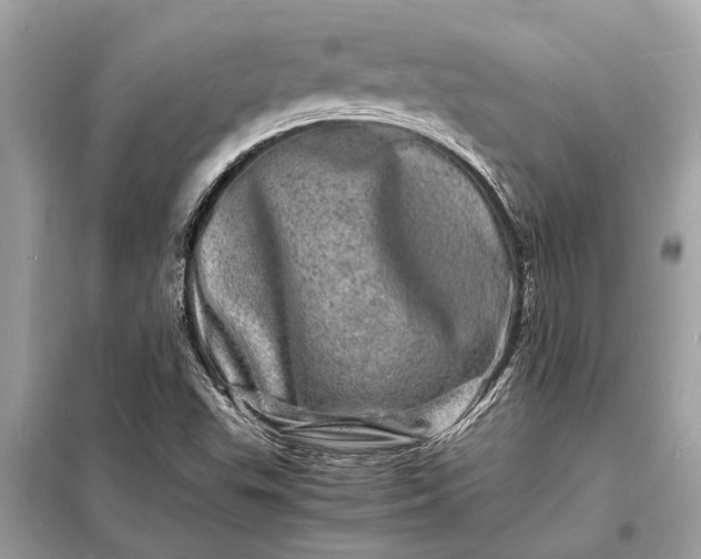 X0000098181503200805081012