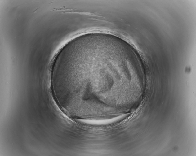 X0000098181504200805081012