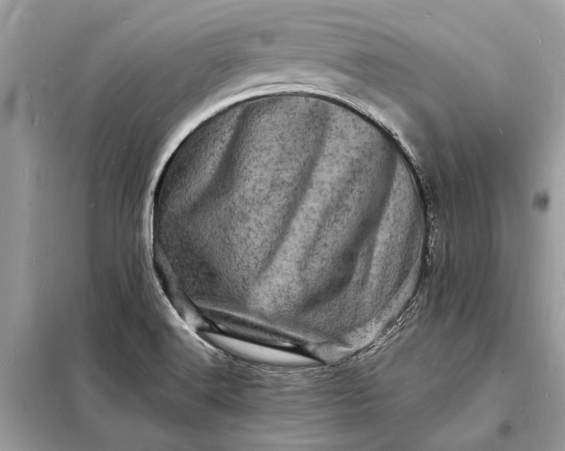 X0000098181516200805081012