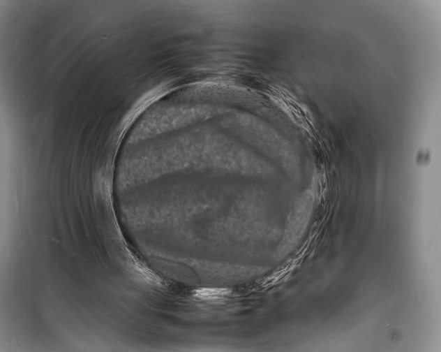 X0000098180051200805151150