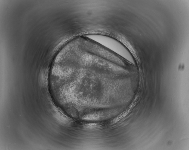 X0000098180058200805151150