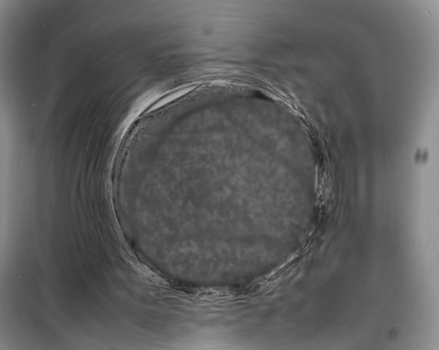 X0000098180099200805151150