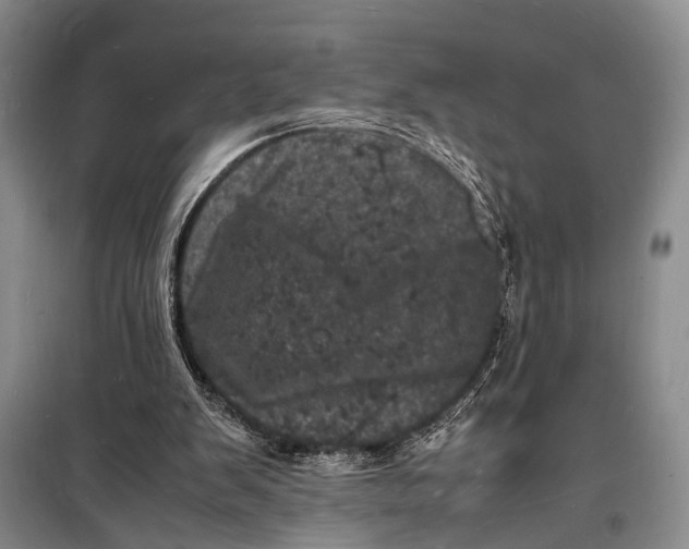 X0000098180103200805151149