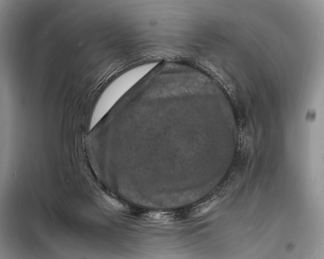 X0000098180117200805151149