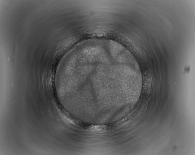 X0000098180126200805151149