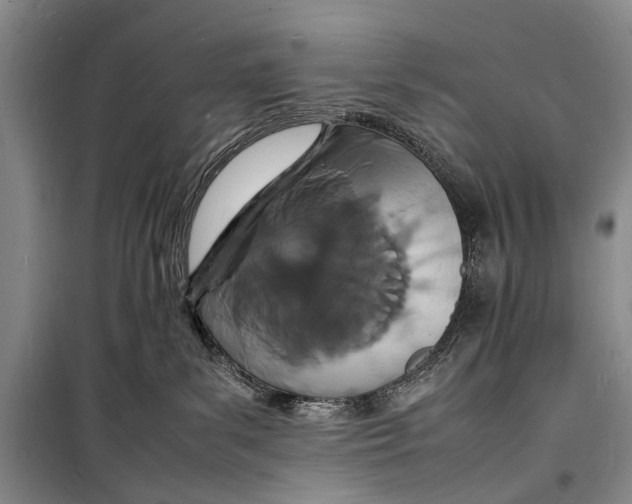 X0000098180139200805151149