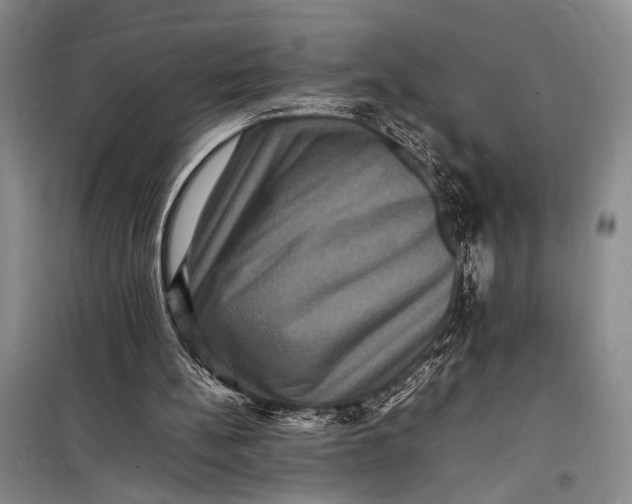 X0000098180148200805151148