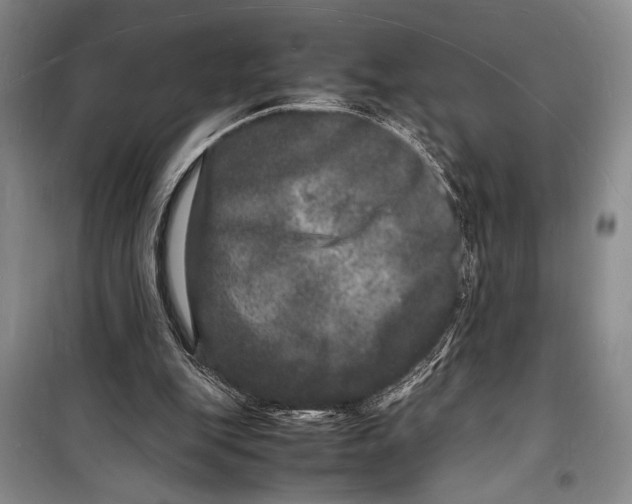 X0000098180151200805151148