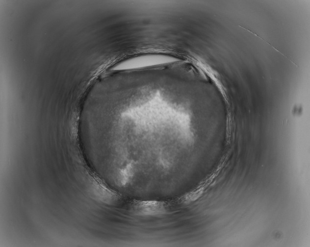 X0000098180153200805151148