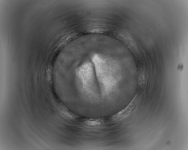 X0000098180175200805151149