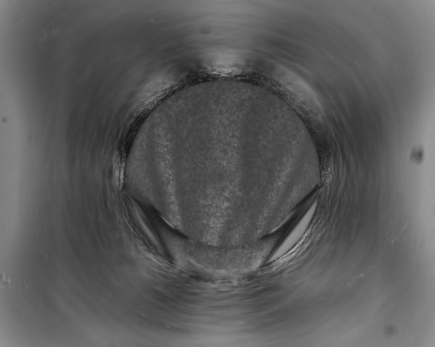 X0000098180180200805151149