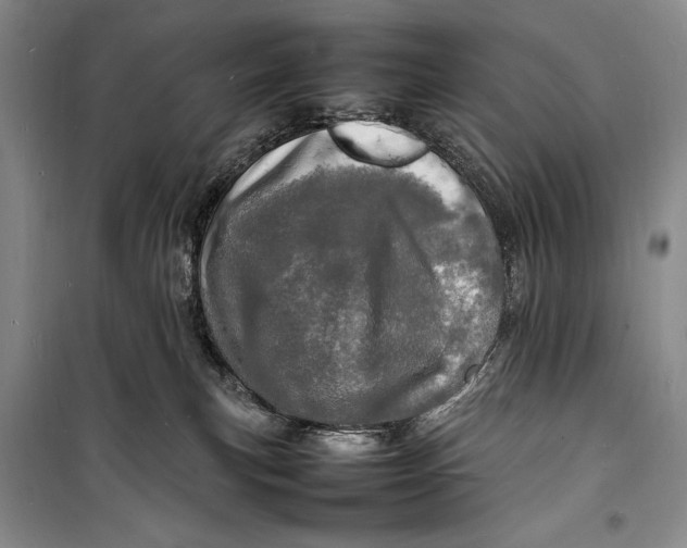 X0000098180183200805151149