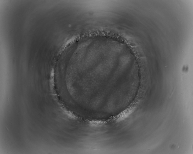 X0000098180192200805151149