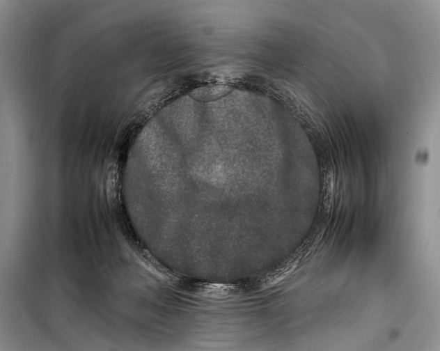 X0000098180222200805151148