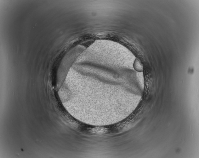 X0000098180225200805151148