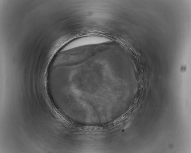 X0000098180242200805151147