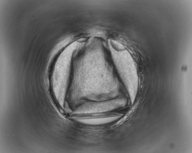 X0000098180245200805151147