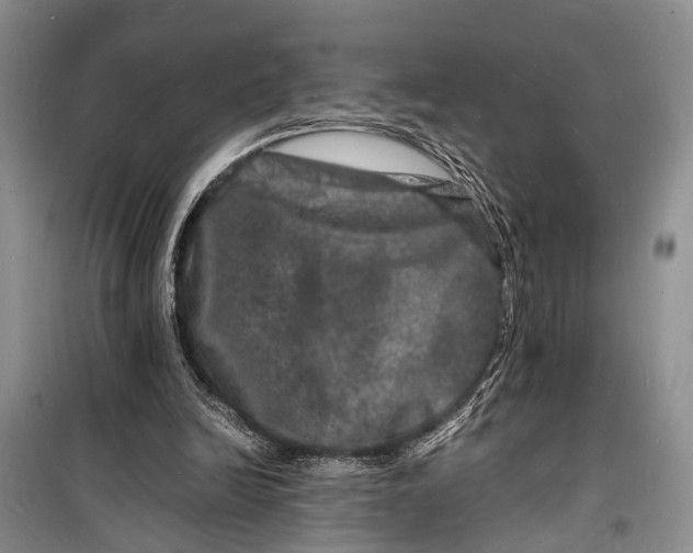 X0000098180246200805151147