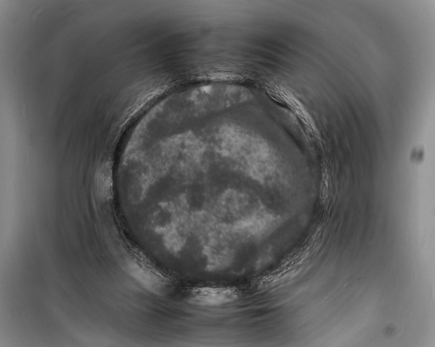 X0000098180251200805151147