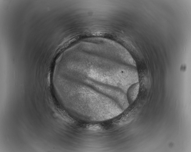 X0000098180262200805151147