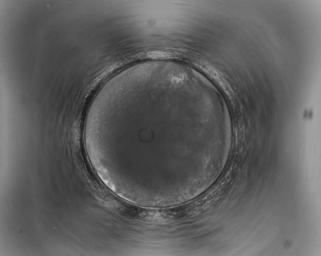 X0000098180297200805151147