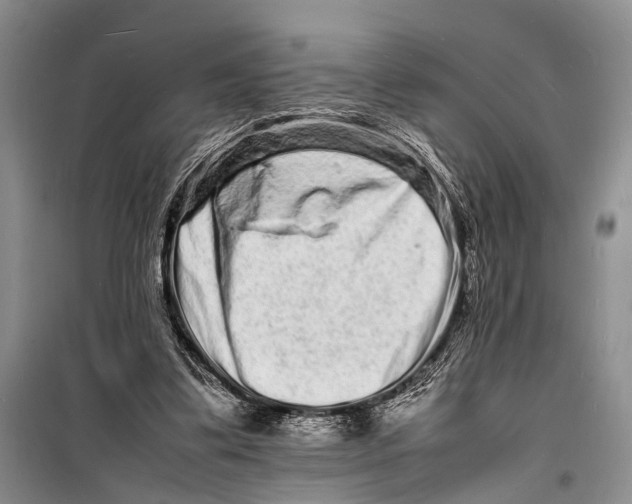 X0000098180299200805151147