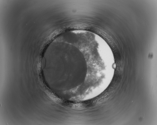 X0000098180309200805151147