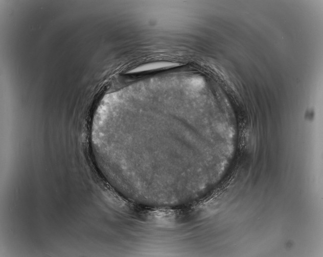 X0000098180317200805151146