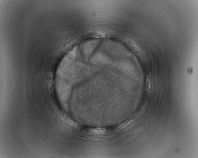 X0000098180318200805151146