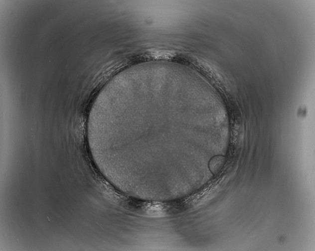 X0000098180321200805151146