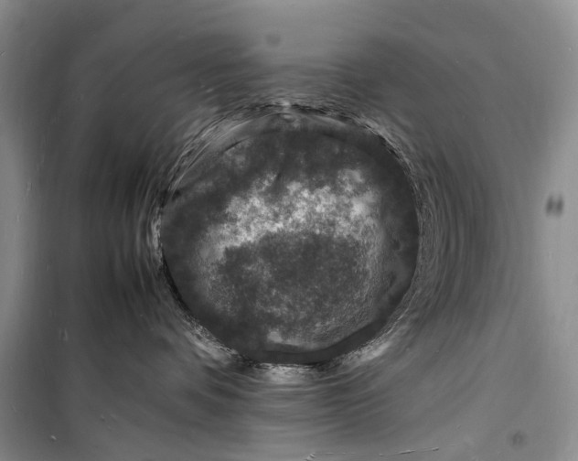 X0000098180336200805151146