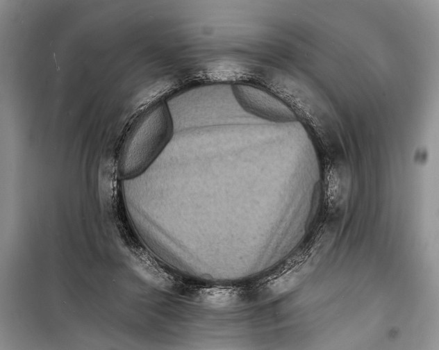 X0000098180356200805151146