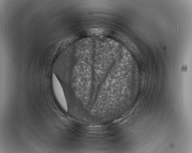 X0000098180361200805151146