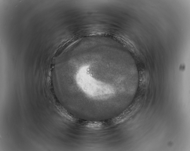 X0000098180369200805151146