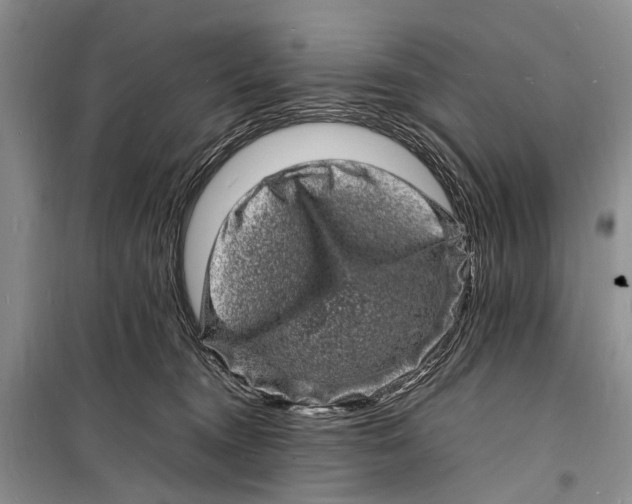 X0000098180372200805151146