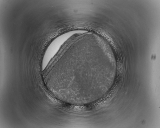 X0000098180401200805151145