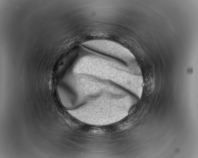 X0000098180416200805151145