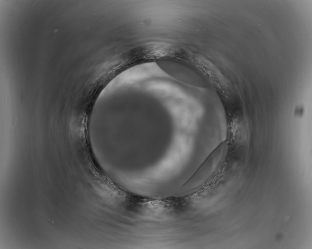 X0000098180423200805151145