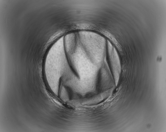 X0000098180442200805151144