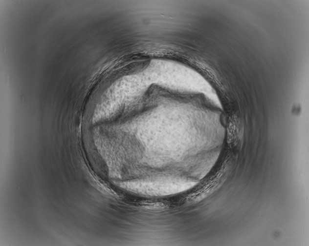 X0000098180454200805151144