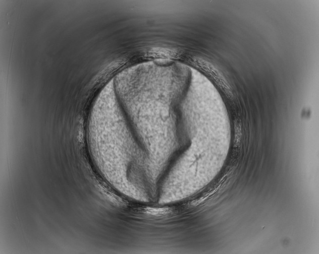 X0000098180457200805151144