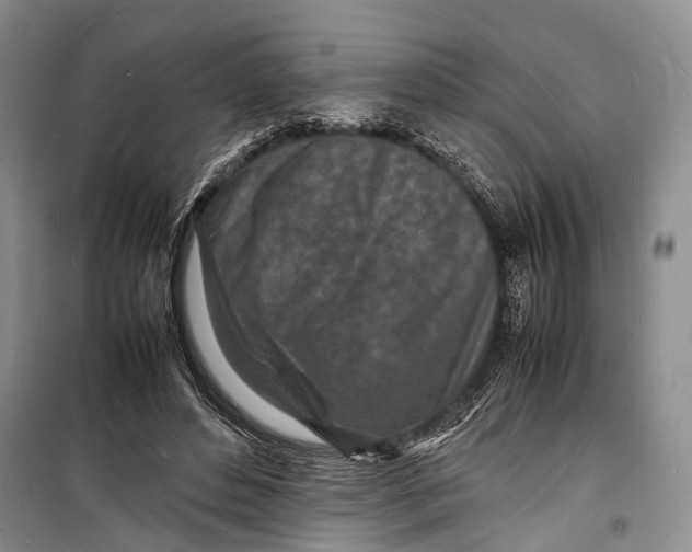 X0000098180496200805151144