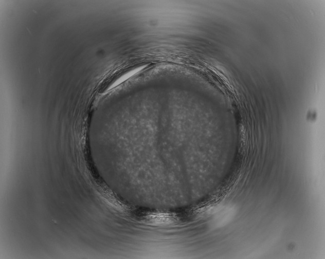 X0000098180499200805151144