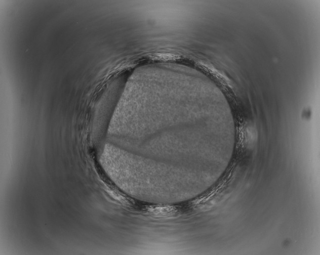 X0000098180517200805151143