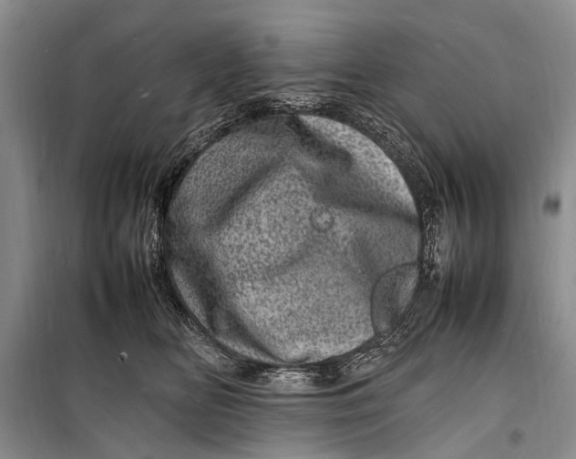 X0000098180518200805151143