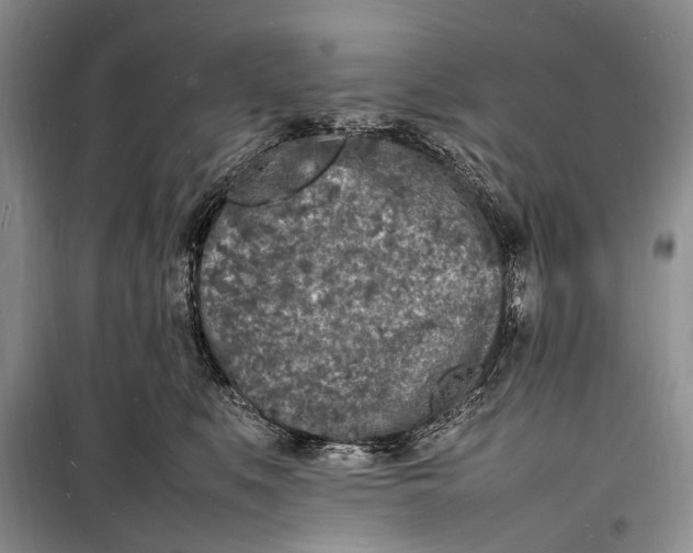 X0000098180519200805151143