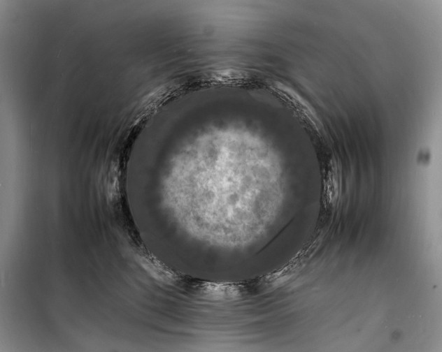 X0000098180520200805151143