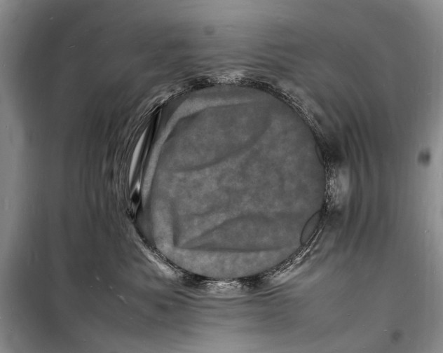 X0000098180525200805151143